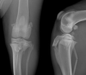 VET-ORTHOPEDIE » Fractures de Salter Harris : exemples